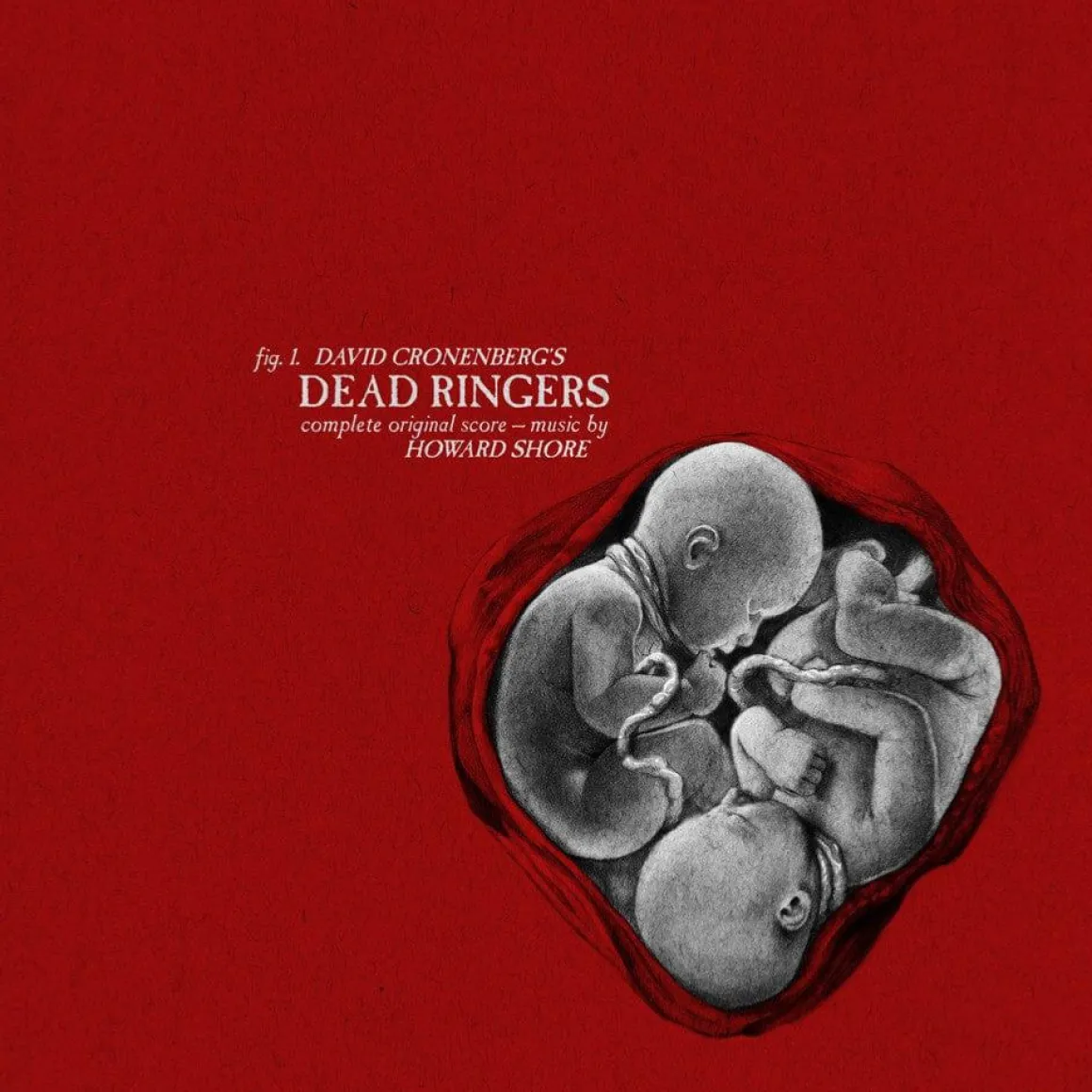 Dead Ringers Original Motion Picture Soundtrack Vinyle - 1LP^MONDO Flash Sale